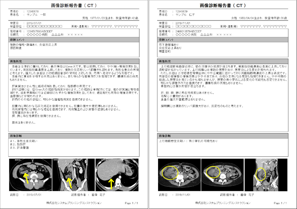 画像診断報告書（CT）